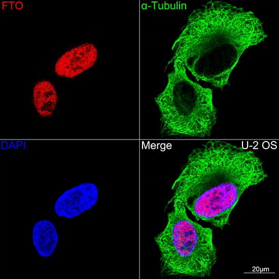 Immunocytochemistry/ Immunofluorescence: FTO Antibody (2Q9K10) [NBP3-16285] - Confocal imaging of U-2 OS cells using FTO Rabbit mAb. The cells were counterstained with alpha-Tubulin Mouse mAb (Green). DAPI was used for nuclear staining (blue). Objective: 100x.