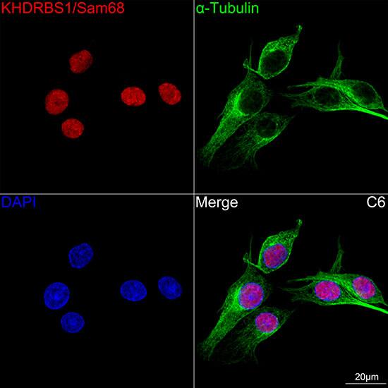 Immunocytochemistry/ Immunofluorescence: SAM68 Antibody (1O7D1) [NBP3-16289] - Confocal imaging of C6 cells using SAM68 Rabbit mAb . The cells were counterstained with alpha-Tubulin Mouse mAb (Green). DAPI was used for nuclear staining (blue). Objective: 100x.