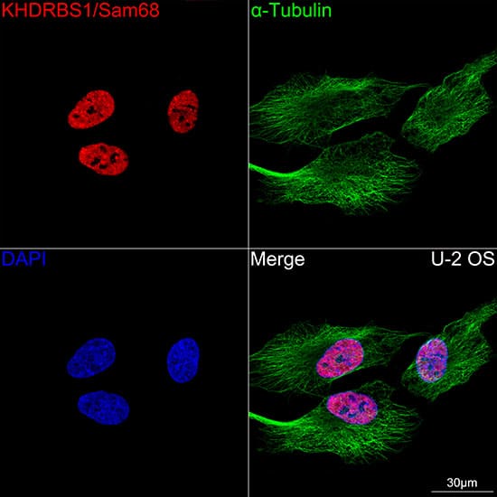 Immunocytochemistry/ Immunofluorescence: SAM68 Antibody (1O7D1) [NBP3-16289] - Confocal imaging of U-2 OS cells using SAM68 Rabbit mAb . The cells were counterstained with alpha-Tubulin Mouse mAb (Green). DAPI was used for nuclear staining (blue). Objective: 100x.