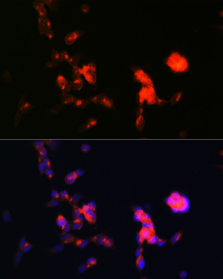 Immunocytochemistry/ Immunofluorescence: Dkk-3 Antibody (1R5E0) [NBP3-16293] - Immunofluorescence analysis of SH-SY5Y cells using Dkk-3 Rabbit mAb at dilution of 1:100 (40x lens). Blue: DAPI for nuclear staining.