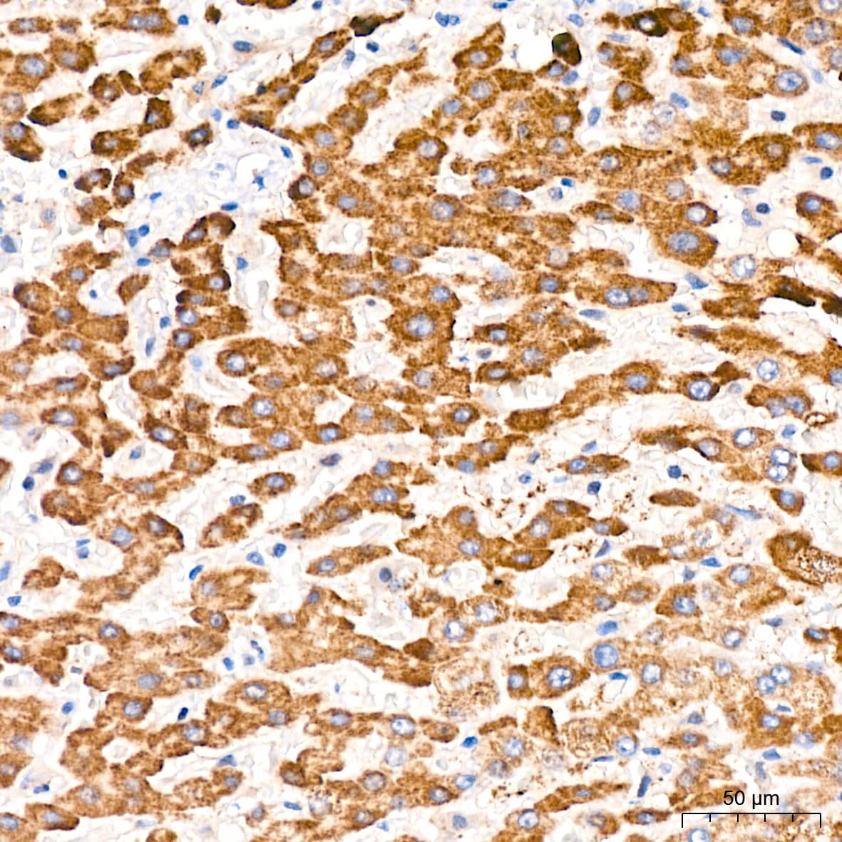 Immunohistochemistry: 6 Phosphofructo 2 Kinase Antibody (7X10D9) [NBP3-16295] - Immunohistochemistry analysis of paraffin-embedded Human liver tissue using 6 Phosphofructo 2 Kinase Rabbit mAb at a dilution of 1:200 (40x lens). High pressure antigen retrieval performed with 0.01M Citrate Bufferr (pH 6.0) prior to IHC staining.
