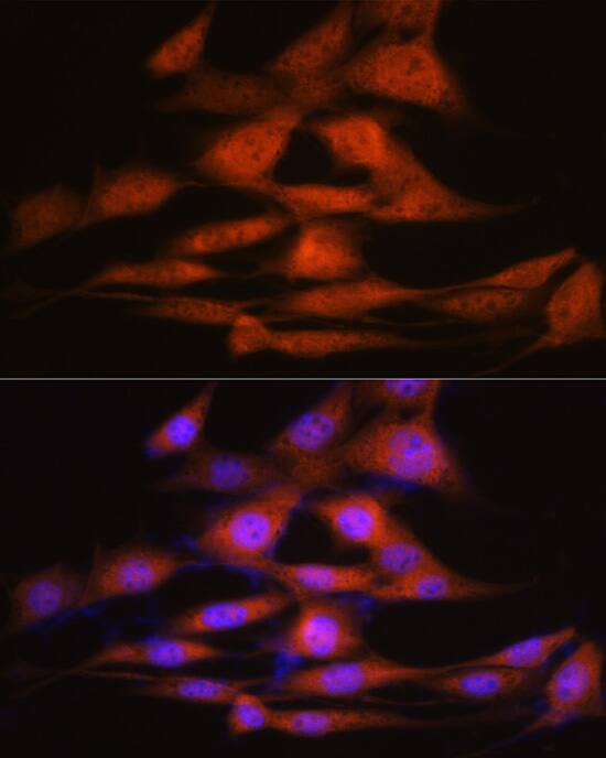 Immunocytochemistry/ Immunofluorescence: LXR alpha/NR1H3 Antibody (7Z4H10) [NBP3-16304] - Immunofluorescence analysis of NIH-3T3 cells using LXR alpha/NR1H3 Rabbit mAb at dilution of 1:100 (40x lens). Secondary antibody: Cy3-conjugated Goat anti-Rabbit IgG (H+L) at 1:500 dilution. Blue: DAPI for nuclear staining.
