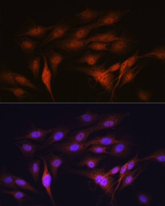 Immunocytochemistry/ Immunofluorescence: LXR alpha/NR1H3 Antibody (7Z4H10) [NBP3-16304] - Immunofluorescence analysis of C6 cells using LXR alpha/NR1H3 Rabbit mAb at dilution of 1:100 (40x lens). Secondary antibody: Cy3-conjugated Goat anti-Rabbit IgG (H+L) at 1:500 dilution. Blue: DAPI for nuclear staining.