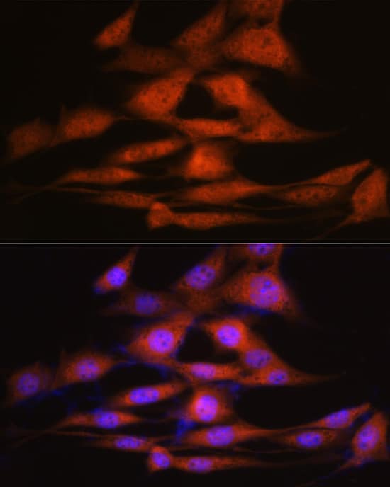 Immunocytochemistry/ Immunofluorescence: LXR alpha/NR1H3 Antibody (7Z4H10) [LXR alpha/NR1H3] - Immunofluorescence analysis of NIH-3T3 cells using LXR alpha/NR1H3 Rabbit mAb  at dilution of 1:100 (40x lens). Secondary antibody: Cy3-conjugated Goat anti-Rabbit IgG (H+L)  at 1:500 dilution. Blue: DAPI for nuclear staining.