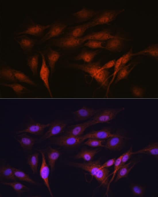 Immunocytochemistry/ Immunofluorescence: LXR alpha/NR1H3 Antibody (7Z4H10) [LXR alpha/NR1H3] - Immunofluorescence analysis of C6 cells using LXR alpha/NR1H3 Rabbit mAb  at dilution of 1:100 (40x lens). Secondary antibody: Cy3-conjugated Goat anti-Rabbit IgG (H+L)  at 1:500 dilution. Blue: DAPI for nuclear staining.
