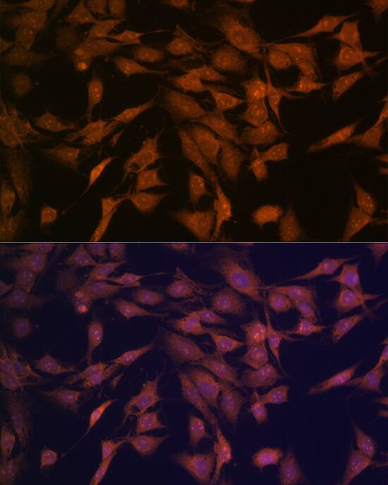 Immunocytochemistry/ Immunofluorescence: CENPC Antibody (5E3K5) [NBP3-16305] - Immunofluorescence analysis of C6 cells using CENPC Rabbit mAb  at dilution of 1:100 (40x lens). Blue: DAPI for nuclear staining.