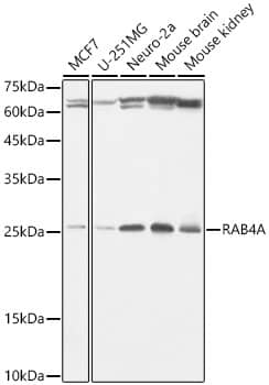 Western Blot: Rab4 Antibody (8I5K1) [NBP3-16307] - Western blot analysis of various lysates, using Rab4 Rabbit mAb  at 1:1000 dilution.Secondary antibody: HRP Goat Anti-Rabbit IgG (H+L)  at 1:10000 dilution.Lysates/proteins: 25ug per lane.Blocking buffer: 3% nonfat dry milk in TBST.Detection: ECL Basic Kit .Exposure time: 1s.