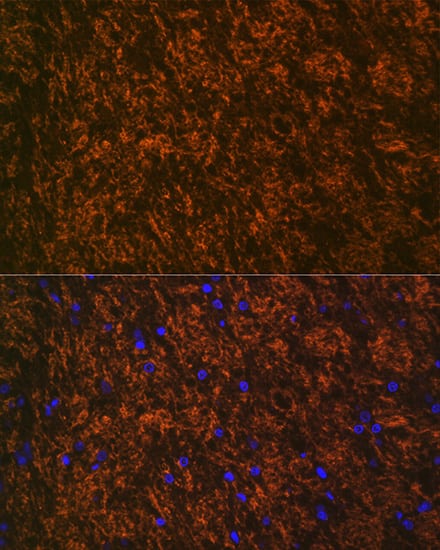 Immunocytochemistry/ Immunofluorescence: MOG Antibody (7G8C4) [NBP3-16310] - Immunofluorescence analysis of paraffin-embedded rat brain using MOG Rabbit mAb at dilution of 1:100 (40x lens). Secondary antibody: Cy3-conjugated Goat anti-Rabbit IgG (H+L) at 1:500 dilution. Blue: DAPI for nuclear staining.