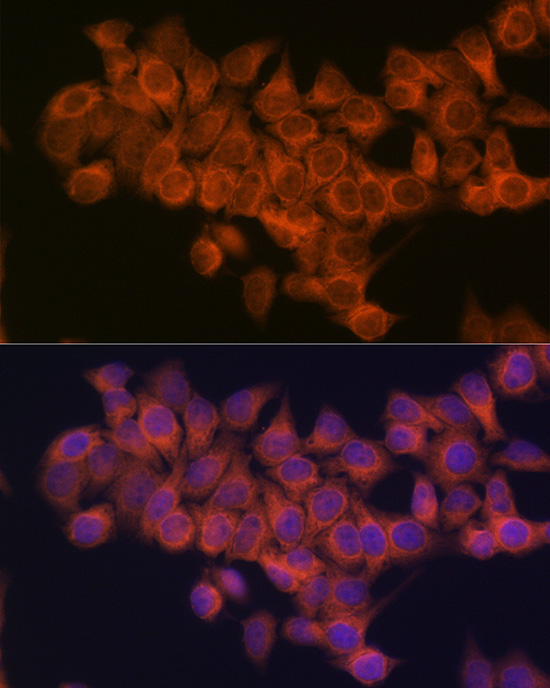 Immunocytochemistry/ Immunofluorescence: NDUFAF1 Antibody (4K8Y8) [NBP3-16313] - Immunofluorescence analysis of HeLa cells using NDUFAF1 Rabbit mAb at dilution of 1:100 (40x lens). Blue: DAPI for nuclear staining.