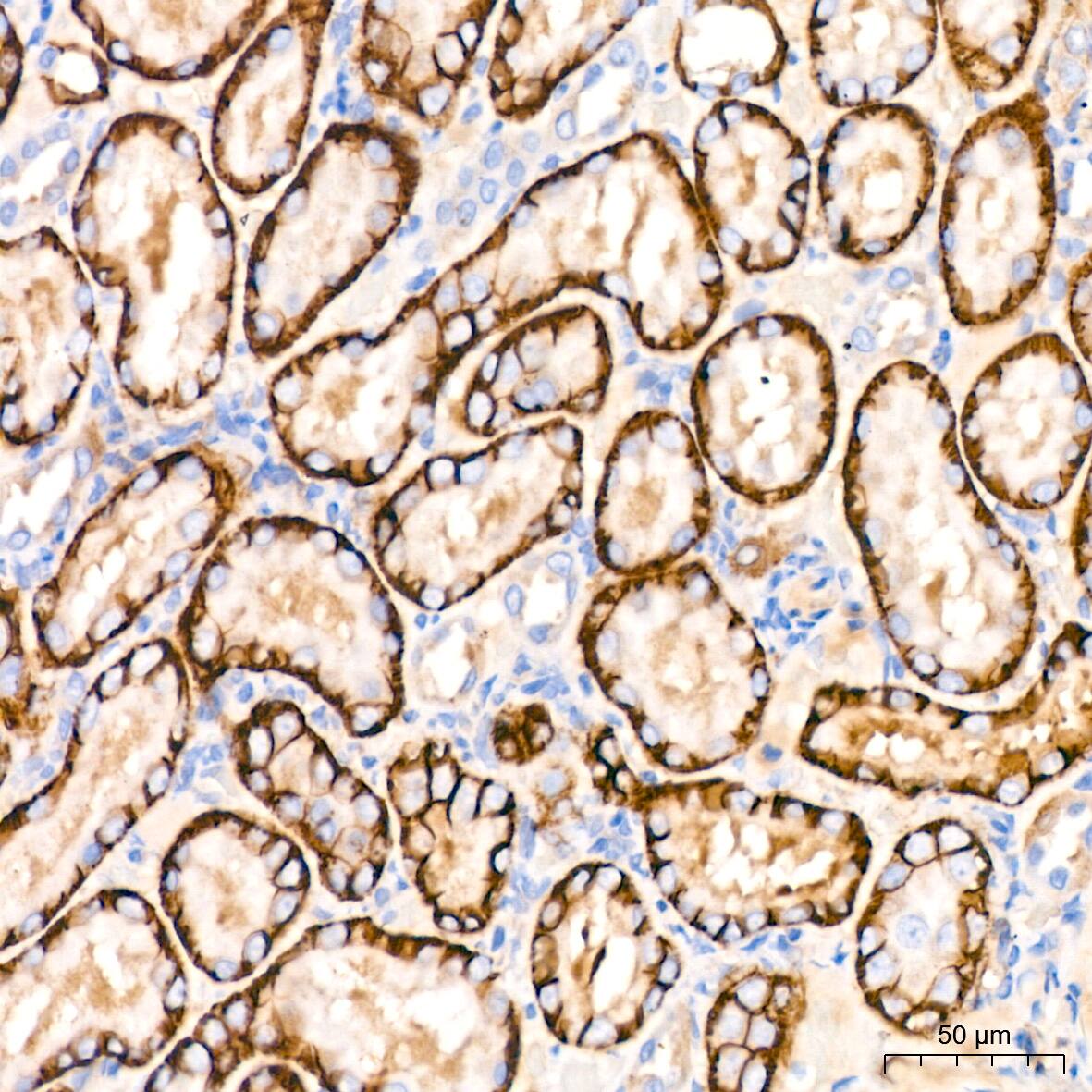 Immunohistochemistry: NDRG1 Antibody (2C6K6) [NBP3-16321] - Immunohistochemistry analysis of NDRG1 in paraffin-embedded rat kidney tissue using NDRG1 Rabbit mAb  at a dilution of 1:200 (40x lens).High pressure antigen retrieval was performed with 0.01 M citrate buffer (pH 6.0) prior to IHC staining.