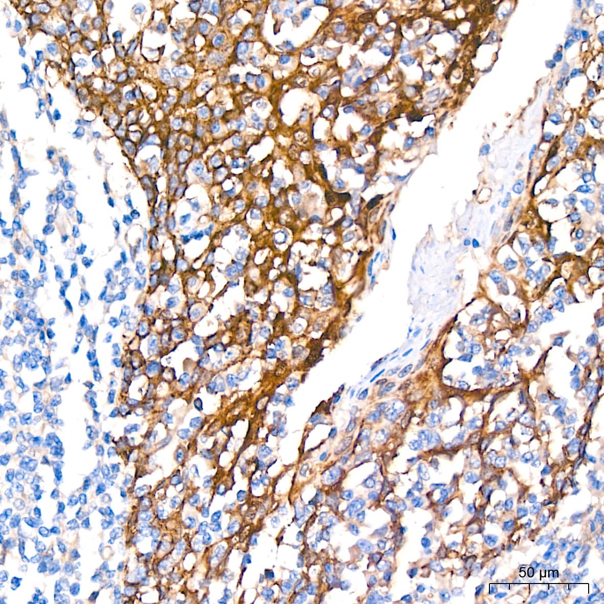 Immunohistochemistry: NDRG1 Antibody (2C6K6) [NBP3-16321] - Immunohistochemistry analysis of NDRG1 in paraffin-embedded human tonsil tissue using NDRG1 Rabbit mAb  at a dilution of 1:200 (40x lens).High pressure antigen retrieval was performed with 0.01 M citrate buffer (pH 6.0) prior to IHC staining.