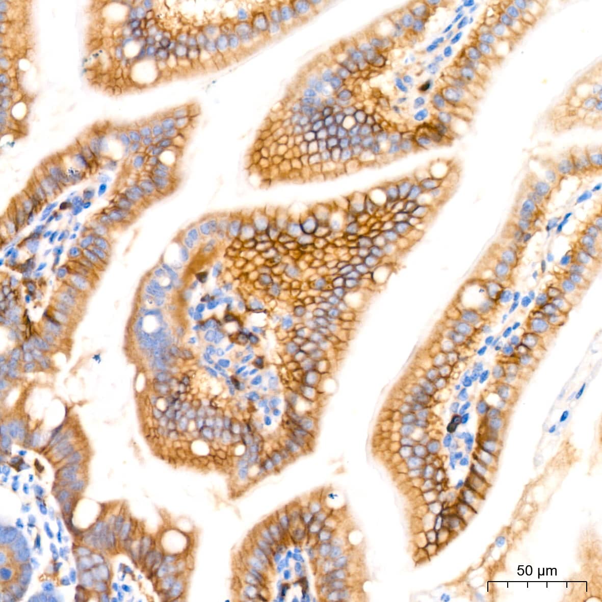 Immunohistochemistry: NDRG1 Antibody (2C6K6) [NBP3-16321] - Immunohistochemistry analysis of NDRG1 in paraffin-embedded mouse colon tissue using NDRG1 Rabbit mAb  at a dilution of 1:200 (40x lens).High pressure antigen retrieval was performed with 0.01 M citrate buffer (pH 6.0) prior to IHC staining.
