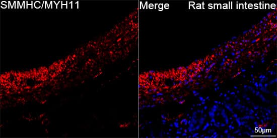 Immunocytochemistry/ Immunofluorescence: Myosin heavy chain 11 Antibody (0O4O4) [NBP3-16323] - Confocal imaging of paraffin-embedded Rat small intestine using Myosin heavy chain 11 Rabbit mAb  followed by a further incubation with Cy3 Goat Anti-Rabbit IgG (H+L).DAPI was used for nuclear staining (Blue). Objective: 40x. Perform high pressure antigen retrieval with 0.01 M citRate buffer (pH 6.0) prior to IF staining.