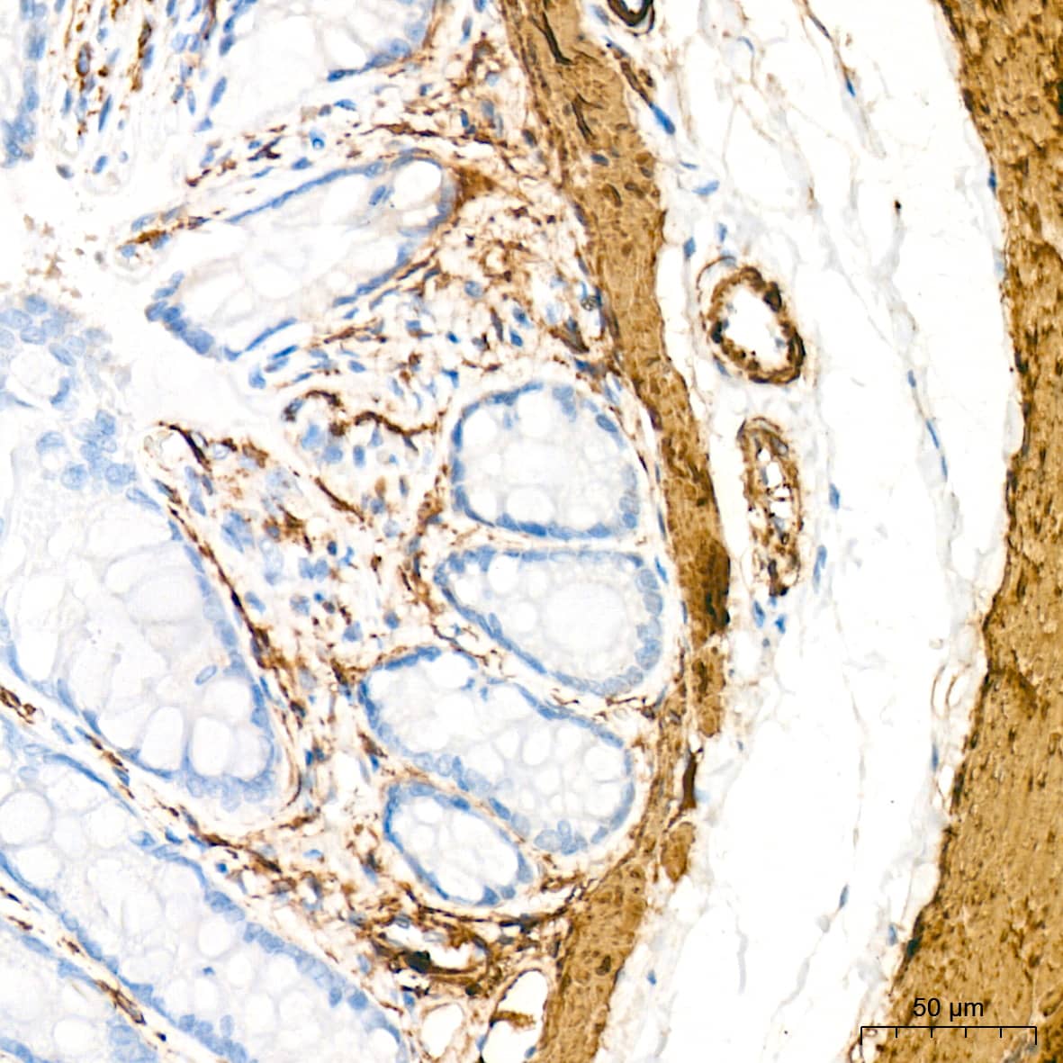 Immunohistochemistry: Myosin heavy chain 11 Antibody (0O4O4) [NBP3-16323] - Immunohistochemistry analysis of paraffin-embedded Rat colon tissue using Myosin heavy chain 11 Rabbit mAb at a dilution of 1:1000 (40x lens). High pressure antigen retrieval performed with 0.01M Citrate Buffer (pH 6.0) prior to IHC staining.