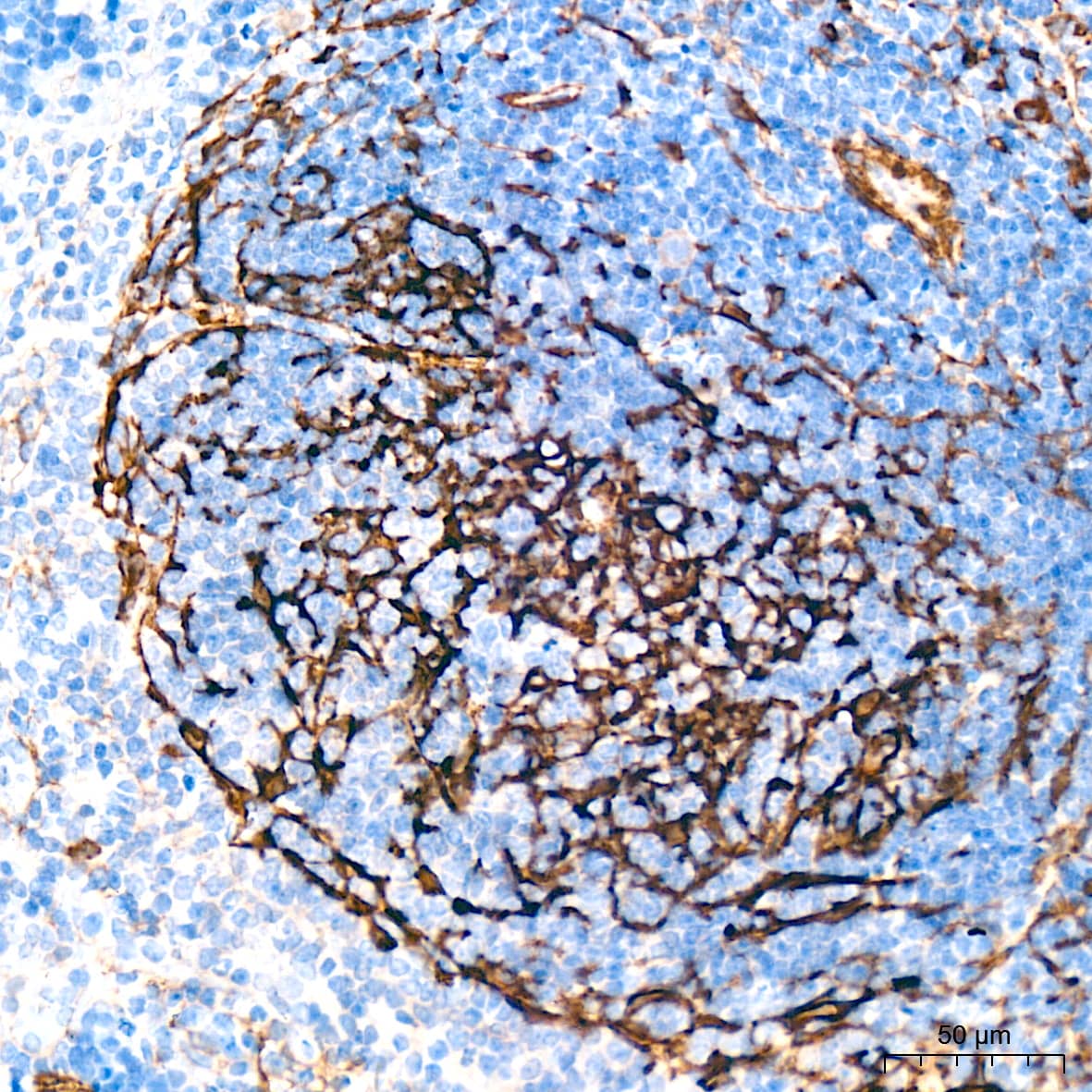 Immunohistochemistry: Myosin heavy chain 11 Antibody (0O4O4) [NBP3-16323] - Immunohistochemistry analysis of paraffin-embedded Mouse spleen tissue using Myosin heavy chain 11 Rabbit mAb at a dilution of 1:1000 (40x lens). High pressure antigen retrieval performed with 0.01M Citrate Buffer (pH 6.0) prior to IHC staining.