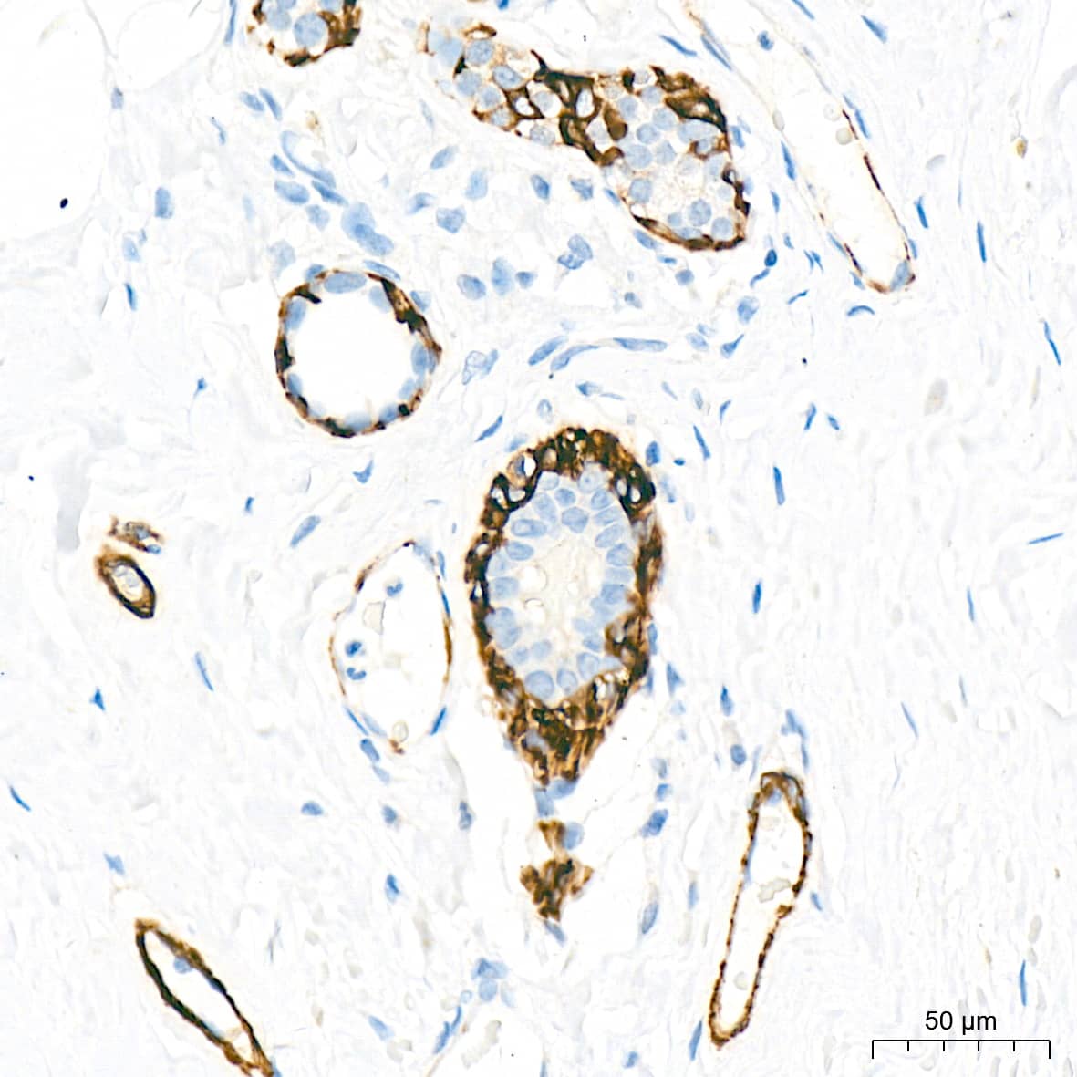 Immunohistochemistry: Myosin heavy chain 11 Antibody (0O4O4) [NBP3-16323] - Immunohistochemistry analysis of paraffin-embedded Human breast tissue using Myosin heavy chain 11 Rabbit mAb at a dilution of 1:1000 (40x lens). High pressure antigen retrieval performed with 0.01M Citrate Buffer (pH 6.0) prior to IHC staining.