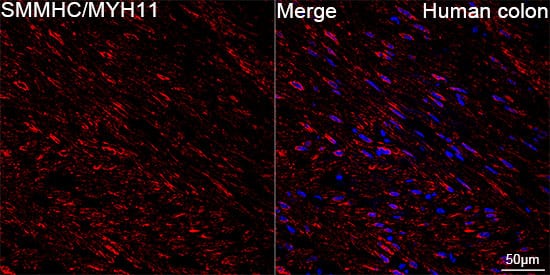 Immunocytochemistry/ Immunofluorescence: Myosin heavy chain 11 Antibody (0O4O4) [NBP3-16323] - Confocal imaging of paraffin-embedded Human colon using Myosin heavy chain 11 Rabbit mAb  followed by a further incubation with Cy3 Goat Anti-Rabbit IgG (H+L).DAPI was used for nuclear staining (Blue). Objective: 40x. Perform high pressure antigen retrieval with 0.01 M citRate buffer (pH 6.0) prior to IF staining.