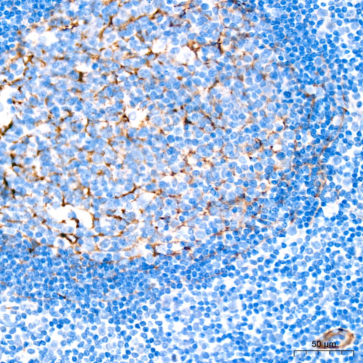 Immunohistochemistry: Myosin heavy chain 11 Antibody (0O4O4) [NBP3-16323] - Immunohistochemistry analysis of paraffin-embedded Human tonsil tissue using Myosin heavy chain 11 Rabbit mAb at a dilution of 1:1000 (40x lens). High pressure antigen retrieval performed with 0.01M Citrate Buffer (pH 6.0) prior to IHC staining.