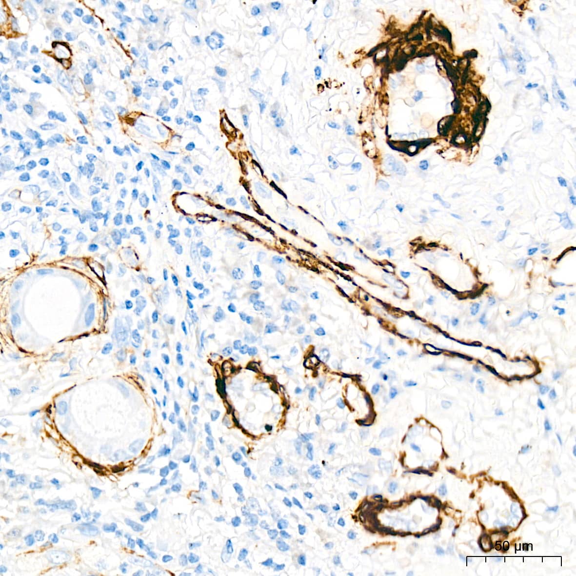 Immunohistochemistry: Myosin heavy chain 11 Antibody (0O4O4) [NBP3-16323] - Immunohistochemistry analysis of paraffin-embedded Human lung tissue using Myosin heavy chain 11 Rabbit mAb at a dilution of 1:1000 (40x lens). High pressure antigen retrieval performed with 0.01M Citrate Buffer (pH 6.0) prior to IHC staining.