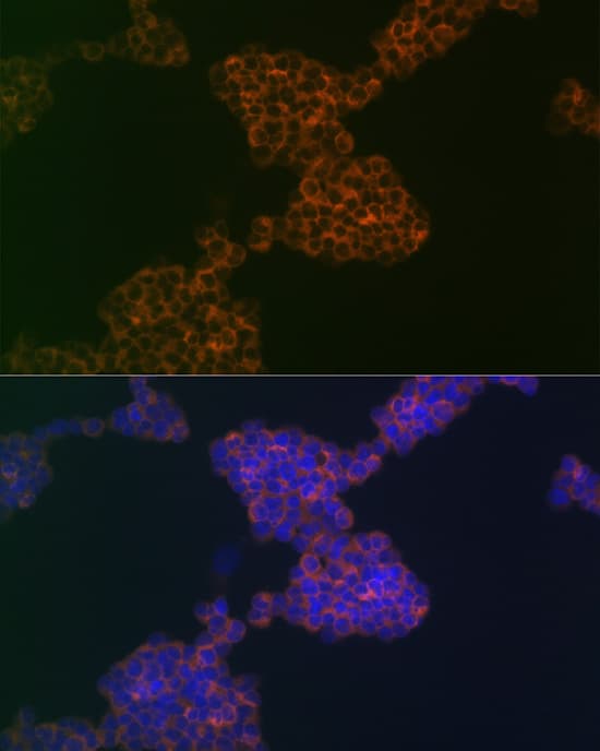 Immunocytochemistry/ Immunofluorescence: CD3 gamma Antibody (7J2L5) [NBP3-16327] - Immunofluorescence analysis of Jurkat cells using CD3 gamma Rabbit mAb  at dilution of 1:100 (40x lens). Blue: DAPI for nuclear staining.