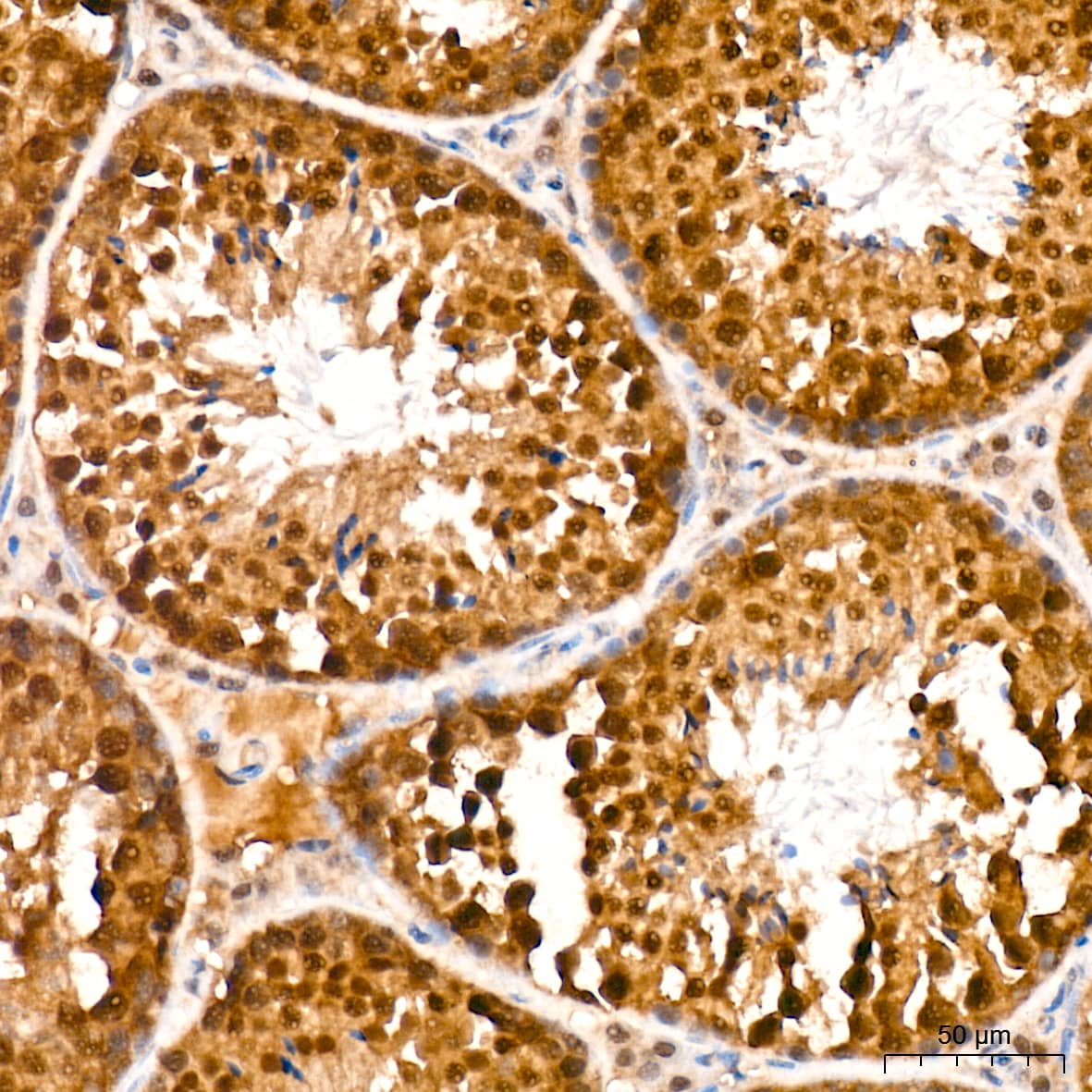 Immunohistochemistry: JAB1 Antibody (3X5F0) [NBP3-16328] - Immunohistochemistry analysis of paraffin-embedded Mouse testis tissue using JAB1 Rabbit mAb at a dilution of 1:100 (40x lens). High pressure antigen retrieval was performed with 0.01 M citrate buffer (pH 6.0) prior to IHC staining.