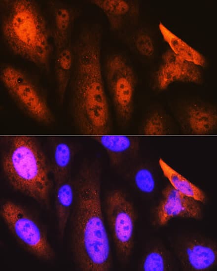 Immunocytochemistry/ Immunofluorescence: JAB1 Antibody (3X5F0) [NBP3-16328] - Immunofluorescence analysis of U-2 OS cells using JAB1 Rabbit mAb at dilution of 1:100 (40x lens). Secondary antibody: Cy3-conjugated Goat anti-Rabbit IgG (H+L) at 1:500 dilution. Blue: DAPI for nuclear staining.