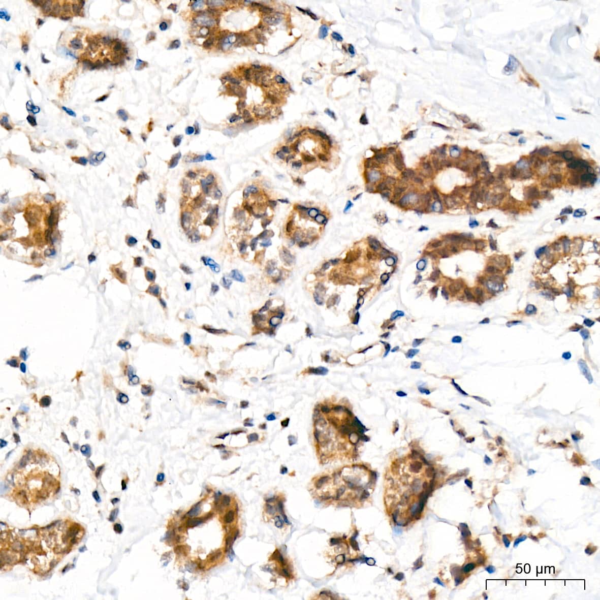 Immunohistochemistry: JAB1 Antibody (3X5F0) [NBP3-16328] - Immunohistochemistry analysis of paraffin-embedded Human breast tissue using JAB1 Rabbit mAb at a dilution of 1:100 (40x lens). High pressure antigen retrieval was performed with 0.01 M citrate buffer (pH 6.0) prior to IHC staining.