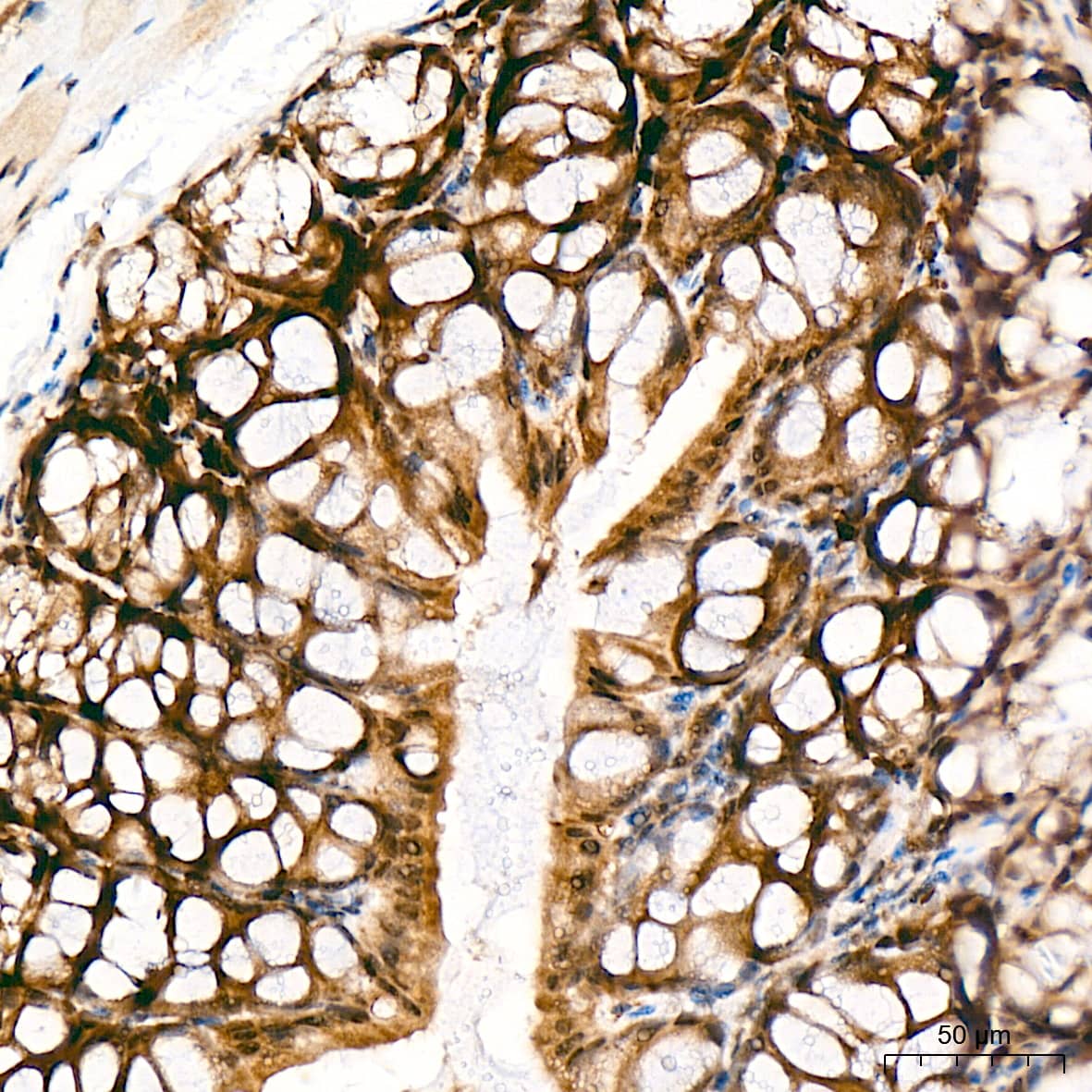 Immunohistochemistry: JAB1 Antibody (3X5F0) [NBP3-16328] - Immunohistochemistry analysis of paraffin-embedded Mouse colon tissue using JAB1 Rabbit mAb at a dilution of 1:100 (40x lens). High pressure antigen retrieval was performed with 0.01 M citrate buffer (pH 6.0) prior to IHC staining.