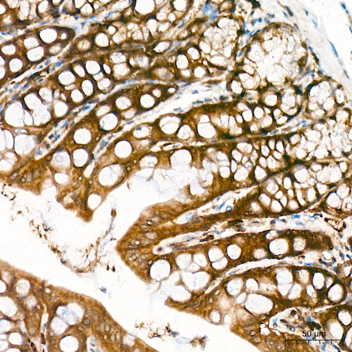 Immunohistochemistry: JAB1 Antibody (3X5F0) [NBP3-16328] - Immunohistochemistry analysis of paraffin-embedded Rat colon tissue using JAB1 Rabbit mAb at a dilution of 1:100 (40x lens). High pressure antigen retrieval was performed with 0.01 M citrate buffer (pH 6.0) prior to IHC staining.