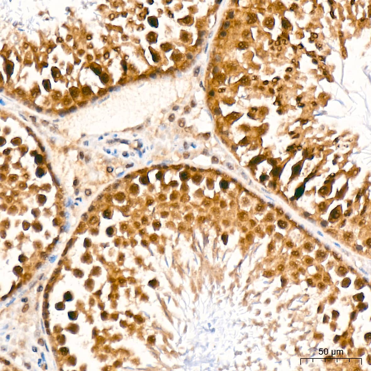 Immunohistochemistry: JAB1 Antibody (3X5F0) [NBP3-16328] - Immunohistochemistry analysis of paraffin-embedded Rat testis tissue using JAB1 Rabbit mAb at a dilution of 1:100 (40x lens). High pressure antigen retrieval was performed with 0.01 M citrate buffer (pH 6.0) prior to IHC staining.