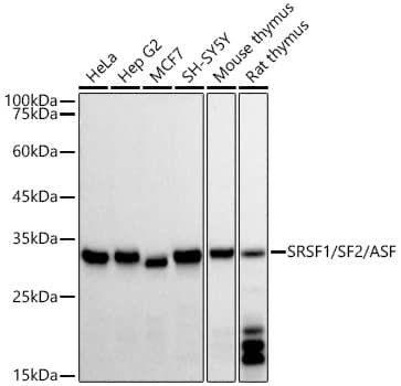 Western Blot: SF2 Antibody (3J5Q9) [NBP3-16329] - Western blot analysis of various lysates, using SF2 Rabbit mAb at 1:3000 dilution.Secondary antibody: HRP-conjugated Goat anti-Rabbit IgG (H+L) at 1:10000 dilution.Lysates/proteins: 25ug per lane.Blocking buffer: 3% nonfat dry milk in TBST.Detection: ECL Basic Kit.Exposure time: 10s.