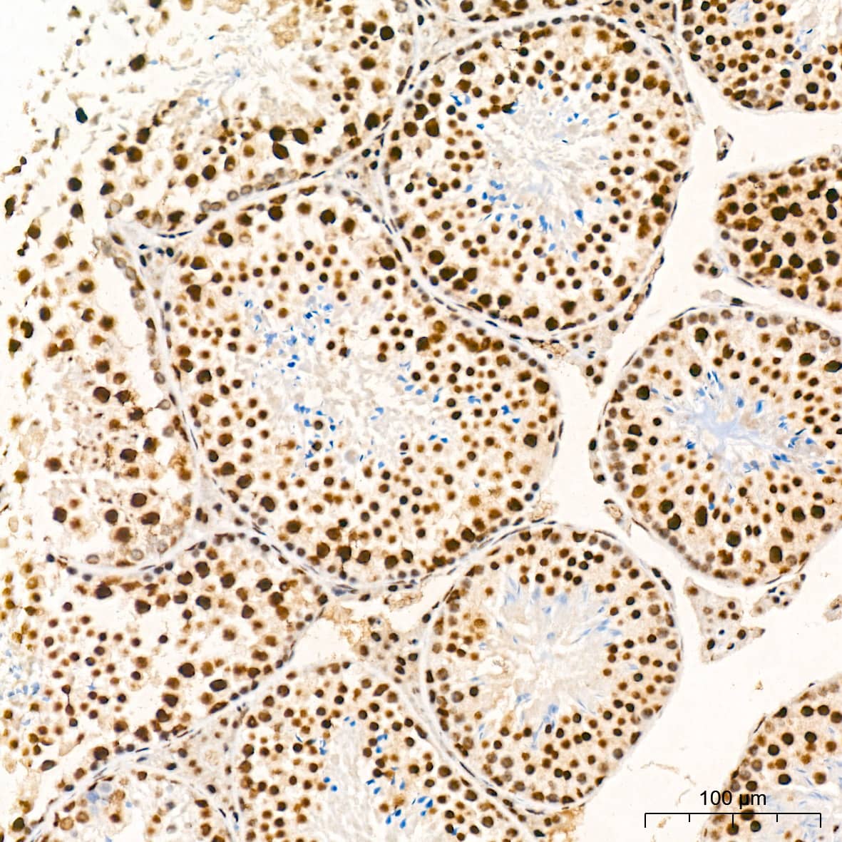 Immunohistochemistry: SF2 Antibody (3J5Q9) [NBP3-16329] - Immunohistochemistry analysis of paraffin-embedded Mouse testis tissue using SF2 Rabbit mAb at a dilution of 1:1000 (40x lens). High pressure antigen retrieval was performed with 0.01 M citrate buffer (pH 6.0) prior to IHC staining.