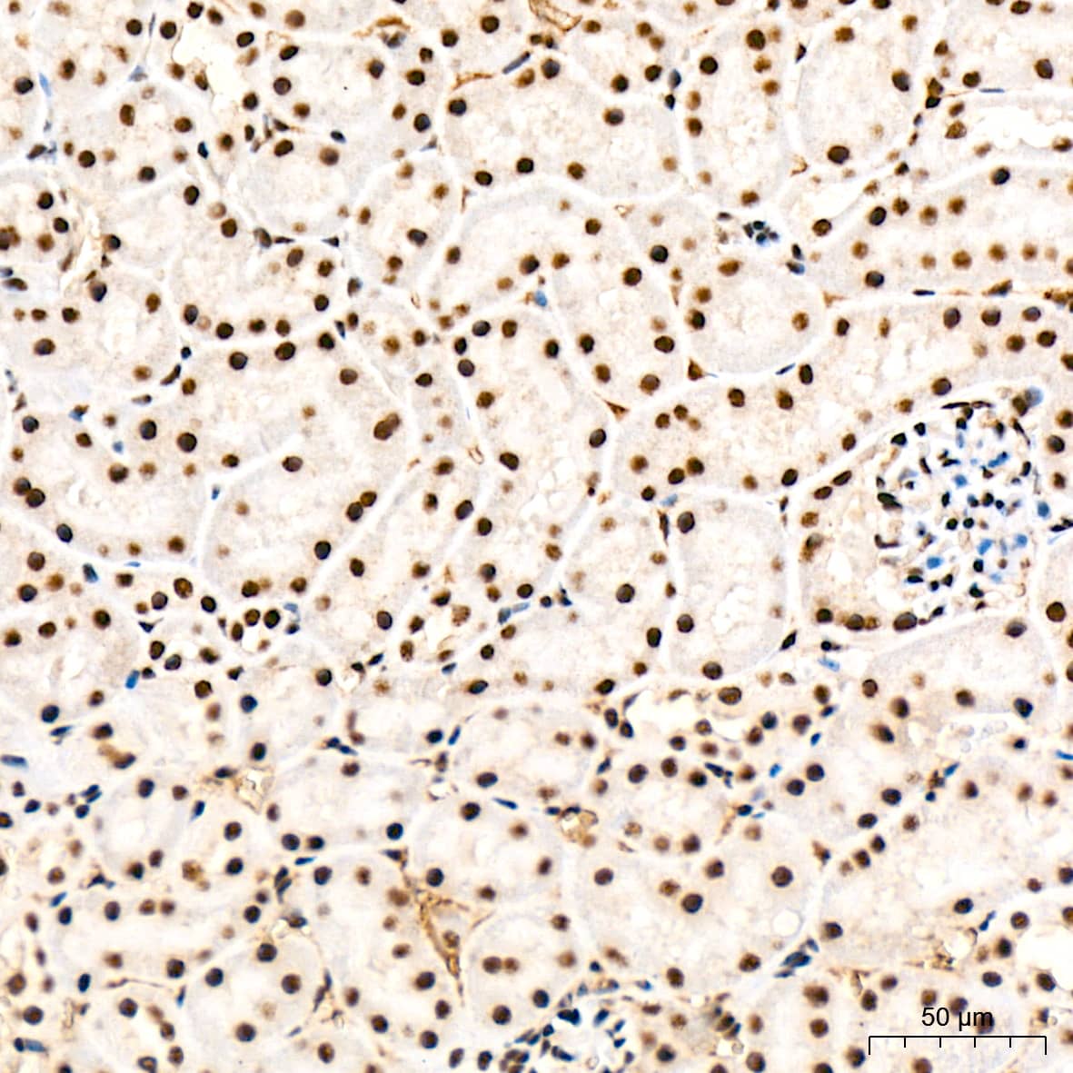 Immunohistochemistry: SF2 Antibody (3J5Q9) [NBP3-16329] - Immunohistochemistry analysis of paraffin-embedded Rat kidney tissue using SF2 Rabbit mAb at a dilution of 1:1000 (40x lens). High pressure antigen retrieval was performed with 0.01 M citrate buffer (pH 6.0) prior to IHC staining.