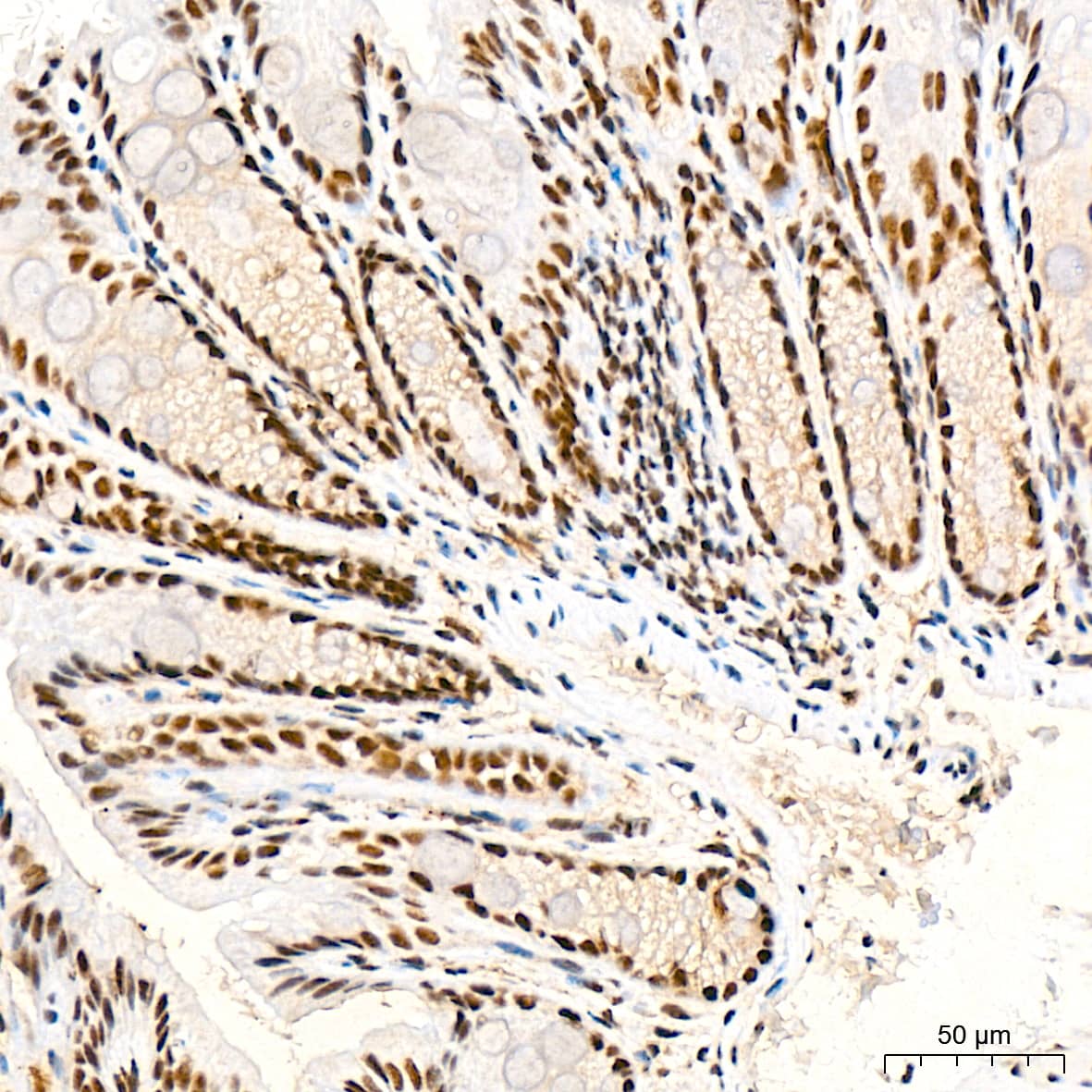 Immunohistochemistry: SF2 Antibody (3J5Q9) [NBP3-16329] - Immunohistochemistry analysis of paraffin-embedded Mouse colon tissue using SF2 Rabbit mAb at a dilution of 1:1000 (40x lens). High pressure antigen retrieval was performed with 0.01 M citrate buffer (pH 6.0) prior to IHC staining.