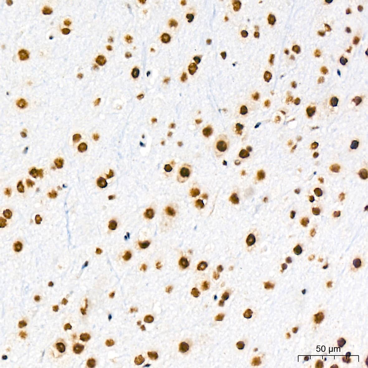 Immunohistochemistry: SF2 Antibody (3J5Q9) [NBP3-16329] - Immunohistochemistry analysis of paraffin-embedded Mouse brain tissue using SF2 Rabbit mAb at a dilution of 1:1000 (40x lens). High pressure antigen retrieval was performed with 0.01 M citrate buffer (pH 6.0) prior to IHC staining.