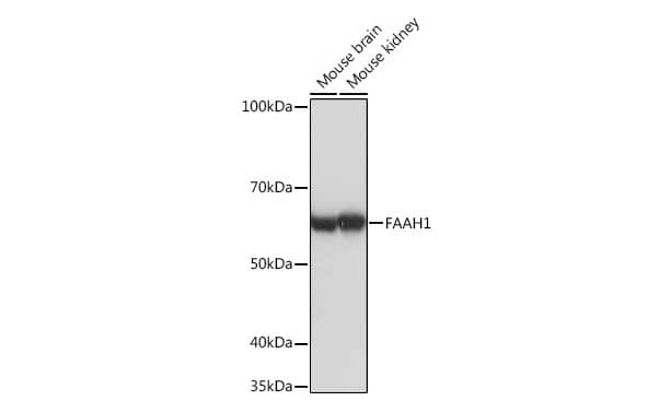 Western Blot FAAH Antibody (10A1M7)