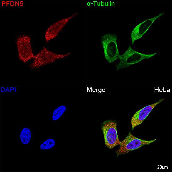 Immunocytochemistry/ Immunofluorescence: PFDN5 Antibody (9Y5H7) [NBP3-16331] - Confocal imaging of HeLa cells using PFDN5 Rabbit mAb  followed by a further incubation with Cy3 Goat Anti-Rabbit IgG (H+L)  . The cells were counterstained with alpha-Tubulin Mouse mAb  followed by incubation with ABflo 488-conjugated Goat Anti-Mouse IgG (H+L) Ab  (Green). DAPI was used for nuclear staining (Blue). Objective: 100x.