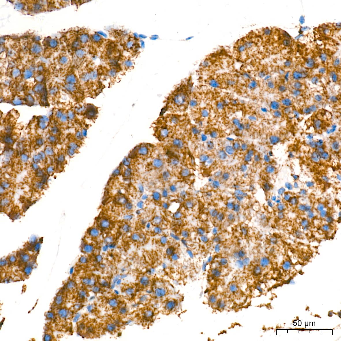 Immunohistochemistry: MAO-A Antibody (9U8P8) [NBP3-16332] - Immunohistochemistry analysis of paraffin-embedded Mouse pancreas tissue using MAO-A Rabbit mAb at a dilution of 1:2000 (40x lens). High pressure antigen retrieval performed with 0.01M Tris-EDTA Buffer (pH 9.0) prior to IHC staining.