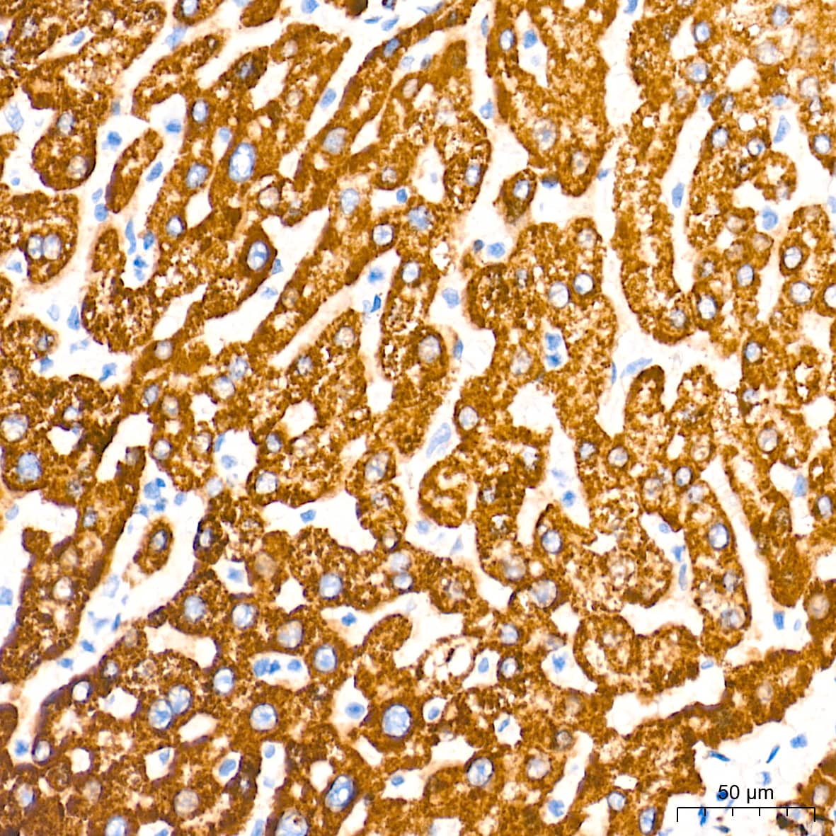 Immunohistochemistry: MAO-A Antibody (9U8P8) [NBP3-16332] - Immunohistochemistry analysis of paraffin-embedded Human liver tissue using MAO-A Rabbit mAb at a dilution of 1:2000 (40x lens). High pressure antigen retrieval performed with 0.01M Tris-EDTA Buffer (pH 9.0) prior to IHC staining.