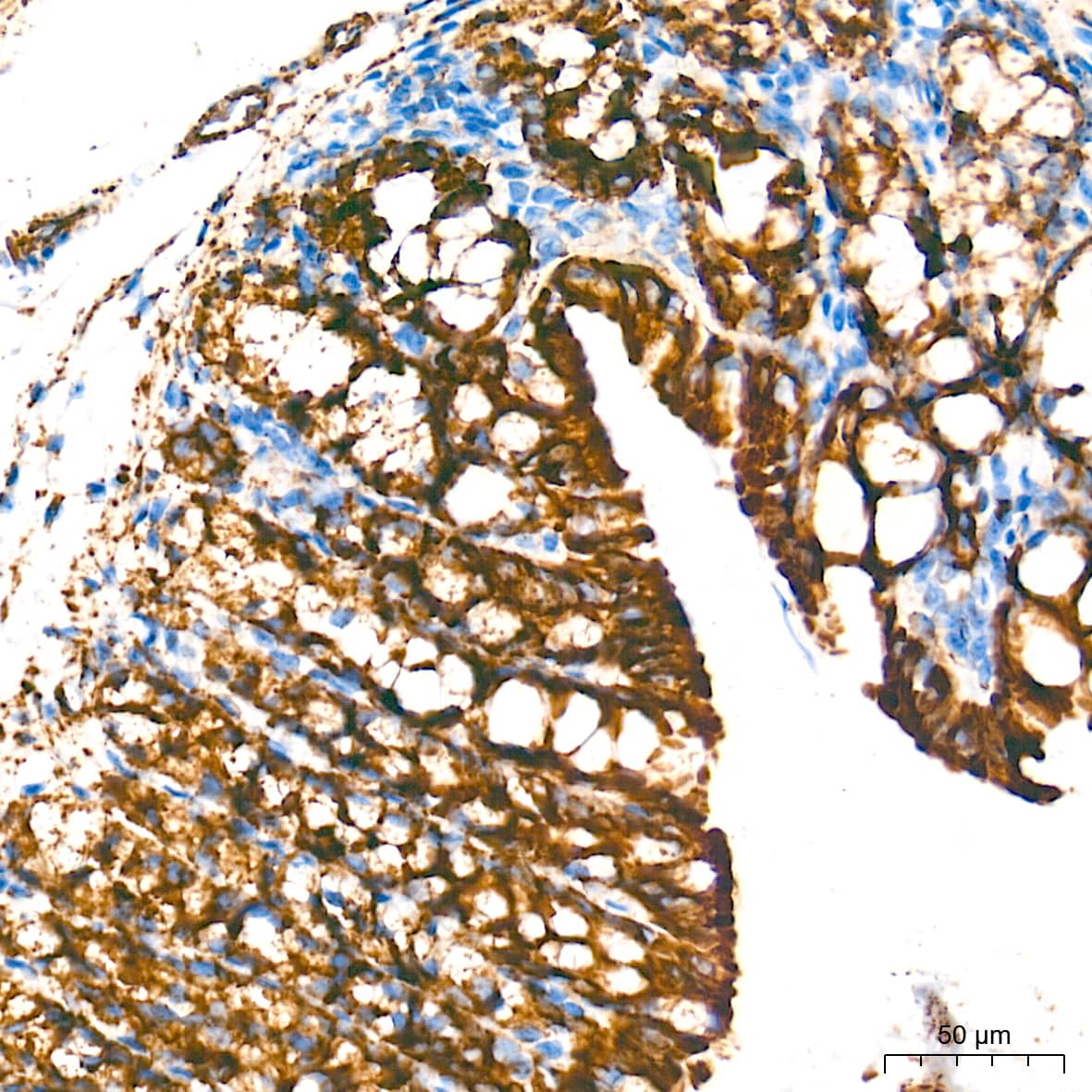 Immunohistochemistry: MAO-A Antibody (9U8P8) [MAO-A] - Immunohistochemistry analysis of paraffin-embedded Mouse colon tissue using MAO-A Rabbit mAb  at a dilution of 1:2000 (40x lens). High pressure antigen retrieval performed with 0.01M Tris-EDTA Buffer (pH 9.0) prior to IHC staining.