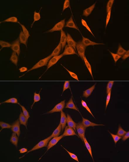 Immunocytochemistry/ Immunofluorescence: RhoC Antibody (7X5I9) [NBP3-16333] - Immunofluorescence analysis of NIH-3T3 cells using RhoC Rabbit mAb at dilution of 1:100 (40x lens). Secondary antibody: Cy3 Goat Anti-Rabbit IgG (H+L) at 1:500 dilution. Blue: DAPI for nuclear staining.