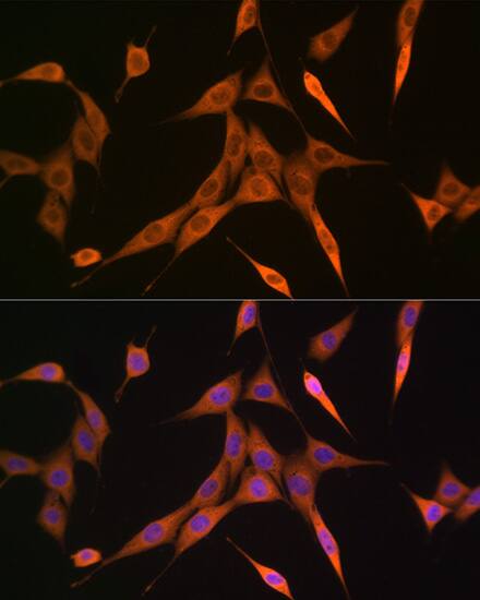 Immunocytochemistry/ Immunofluorescence: RhoC Antibody (7X5I9) [RhoC] - Immunofluorescence analysis of NIH-3T3 cells using RhoC Rabbit mAb  at dilution of 1:100 (40x lens). Secondary antibody: Cy3 Goat Anti-Rabbit IgG (H+L)  at 1:500 dilution. Blue: DAPI for nuclear staining.