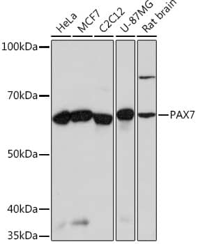 Western Blot: Pax7 Antibody (5G2Q9) [NBP3-16337] - Western blot analysis of various lysates using Pax7 Rabbit mAb at 1:1000 dilution.Secondary antibody: HRP-conjugated Goat anti-Rabbit IgG (H+L) at 1:10000 dilution.Lysates/proteins: 25ug per lane.Blocking buffer: 3% nonfat dry milk in TBST.Detection: ECL Basic Kit.Exposure time: 3min.