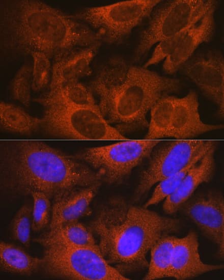 Immunocytochemistry/ Immunofluorescence: PSP94/MSMB Antibody (4L8B5) [NBP3-16346] - Immunofluorescence analysis of U-2 OS cells using PSP94/MSMB Rabbit mAb  at dilution of 1:100 (40x lens). Blue: DAPI for nuclear staining.