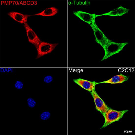 Immunocytochemistry/ Immunofluorescence: PMP70 Antibody (3V4K3) [NBP3-16348] - Confocal imaging of C2C12 cells using PMP70 Rabbit mAb  followed by a further incubation with Cy3 Goat Anti-Rabbit IgG (H+L).The cells were counterstained with alpha-Tubulin Mouse mAb followed by incubation with ABflo(R) 488-conjugated Goat Anti-Mouse IgG (H+L) Ab (Green).DAPI was used for nuclear staining (Blue). Objective: 100x.