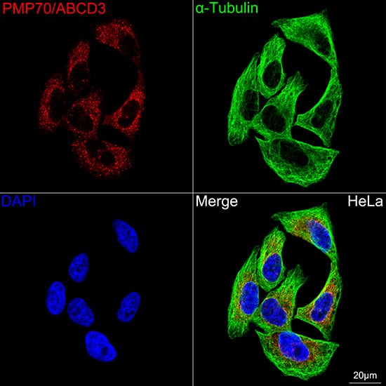 Immunocytochemistry/ Immunofluorescence: PMP70 Antibody (3V4K3) [NBP3-16348] - Confocal imaging of HeLa cells using PMP70 Rabbit mAb  followed by a further incubation with Cy3 Goat Anti-Rabbit IgG (H+L).The cells were counterstained with alpha-Tubulin Mouse mAb followed by incubation with ABflo(R) 488-conjugated Goat Anti-Mouse IgG (H+L) Ab (Green).DAPI was used for nuclear staining (Blue). Objective: 100x.