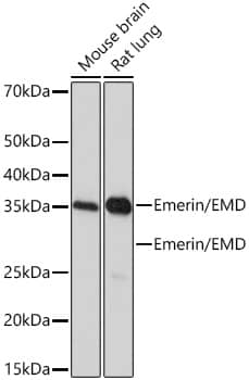 Western Blot: Emerin Antibody (10Y5K9) [NBP3-16351] - Western blot analysis of various lysates using Emerin Rabbit mAb at 1:1000 dilution.Secondary antibody: HRP-conjugated Goat anti-Rabbit IgG (H+L) at 1:10000 dilution.Lysates/proteins: 25ug per lane.Blocking buffer: 3% nonfat dry milk in TBST.Detection: ECL Basic Kit.Exposure time: 90s.