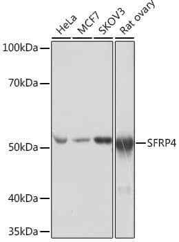 Western Blot: sFRP-4 Antibody (7Z6Q1) [sFRP-4] - Western blot analysis of various lysates using sFRP-4 Rabbit mAb  at 1:1000 dilution incubated overnight at 4C.Secondary antibody: HRP-conjugated Goat anti-Rabbit IgG (H+L)  at 1:10000 dilution.Lysates/proteins: 25ug per lane.Blocking buffer: 3% nonfat dry milk in TBST.Detection: ECL Basic Kit .Exposure time: 1s.