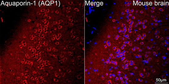 Immunocytochemistry/ Immunofluorescence: Aquaporin 1/AQP1 Antibody (8V1O3) [NBP3-16354] - Confocal imaging of paraffin-embedded Mouse brain tissue using Aquaporin-1 Rabbit mAb followed by a further incubation with Cy3 Goat Anti-Rabbit IgG (H+L) . DAPI was used for nuclear staining (Blue). Microwave antigen retrieval performed with 0.01M Citrate Buffer (pH 6.0) prior to IF staining. Objective: 40x.