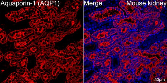 Immunocytochemistry/ Immunofluorescence: Aquaporin 1/AQP1 Antibody (8V1O3) [NBP3-16354] - Confocal imaging of paraffin-embedded Mouse kidney tissue using Aquaporin-1 Rabbit mAb followed by a further incubation with Cy3 Goat Anti-Rabbit IgG (H+L) . DAPI was used for nuclear staining (Blue). Microwave antigen retrieval performed with 0.01M Citrate Buffer (pH 6.0) prior to IF staining. Objective: 40x.